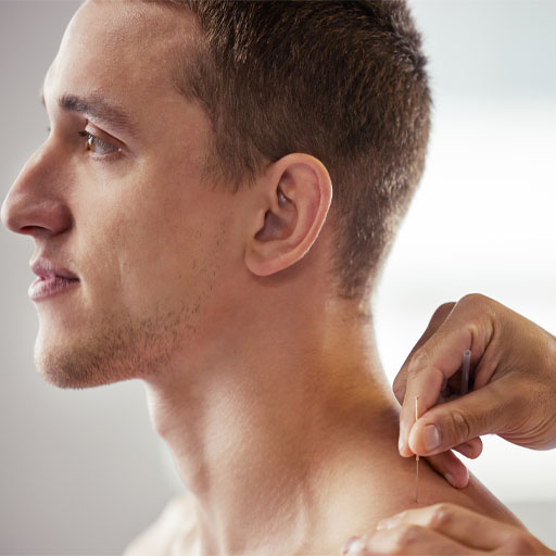 s-acupuncture